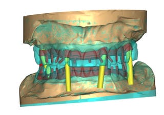 Digital Dental Workflow
